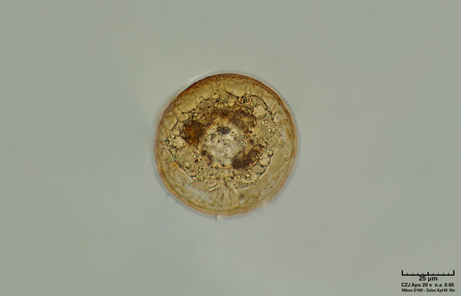 Arcella